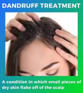 dandruff treatment