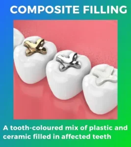 dental composite filling