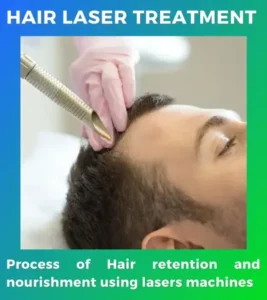 hair laser treatment