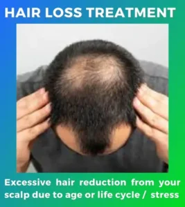 hair loss treatment