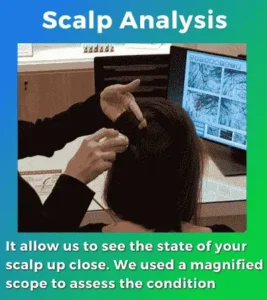 Scalp Analysis treatment
