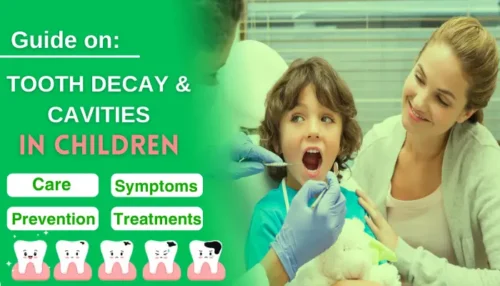 Read more about the article Children Tooth Decay Prevention, Care, Treatments, 10 Tips with Guide