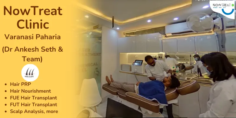 NowTreat hair transplant clinic in Varanasi
