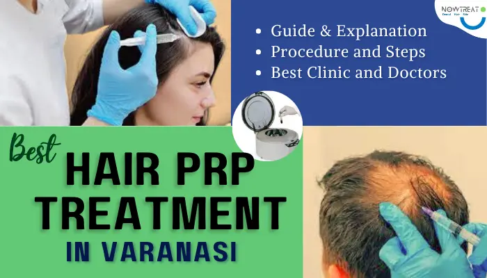 You are currently viewing GFC Hair PRP Treatment in Varanasi | Specialized Doctors