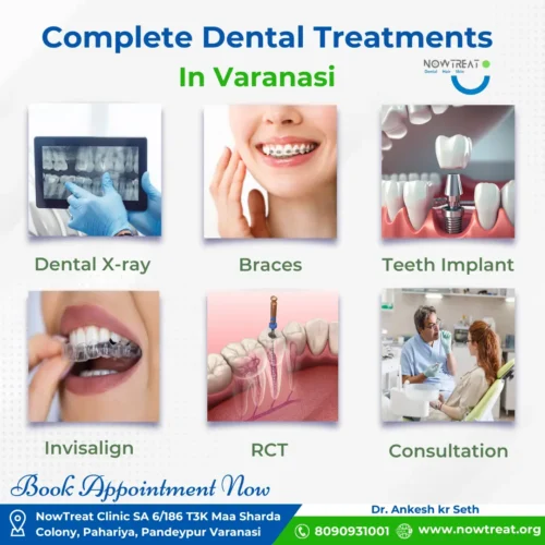 Best Hair Treatments Clinic in Varanasi at NowTreat : Dental X-ray, Braces, Teeth Implant, Invisalign and Consultation