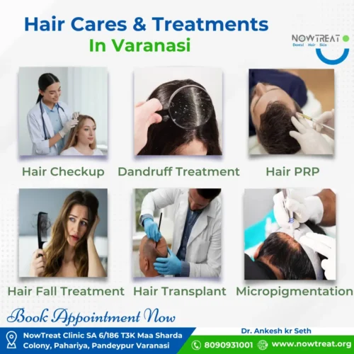 Best Hair Treatments in Varanasi at NowTreat: Hair Checkup, Dandruff Treatment, Hair PRP, Hair Transplant