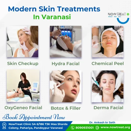 Best Skin Treatments in Varanasi at NowTreat: Skin Checkup, Hydra Facial, Chemical Peel, and Botox Filler