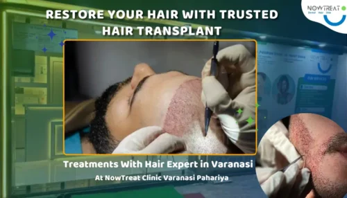 Read more about the article Top Hair Transplant in Varanasi with Hair Restoration Doctor