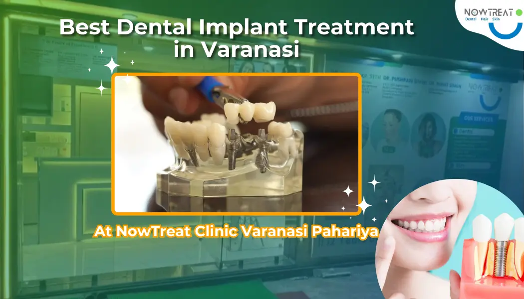 You are currently viewing Best Dental Implant Treatment in Varanasi | NowTreat Clinic