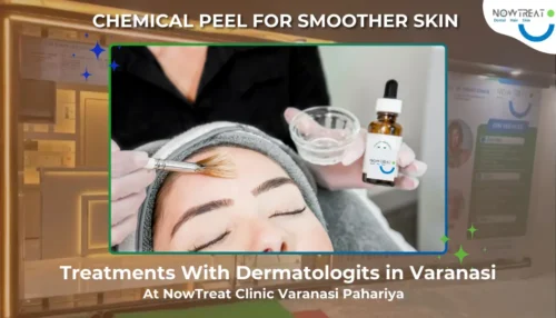 Read more about the article Best Chemical Peel Treatment in Varanasi with Expert Doctors