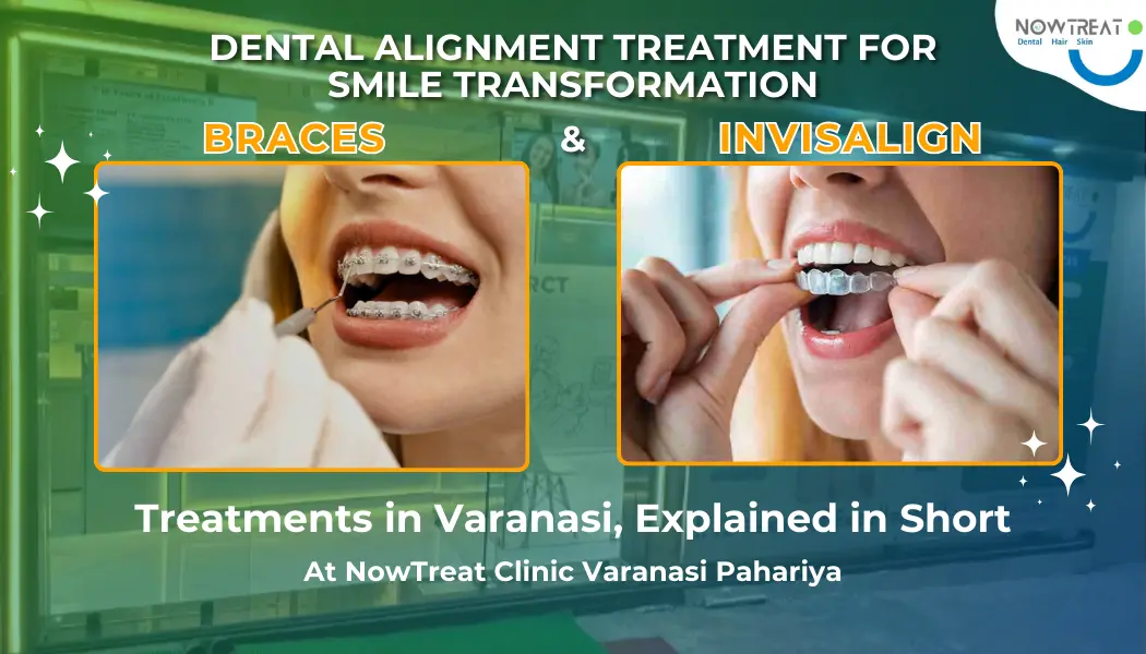 You are currently viewing Braces and Invisalign Teeth Alignment Treatment in Varanasi