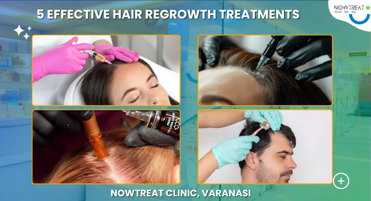 You are currently viewing Best 5 Hair Regrowth Treatments in Varanasi, NowTreat Clinic