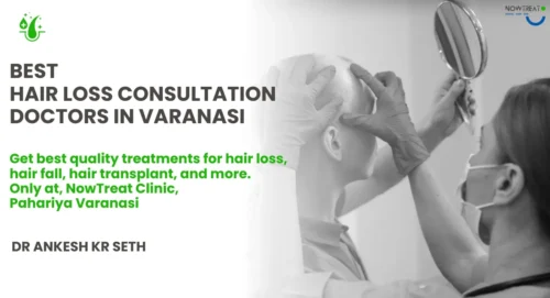 Read more about the article Expert Hair Loss Consultation at NowTreat Clinic Varanasi